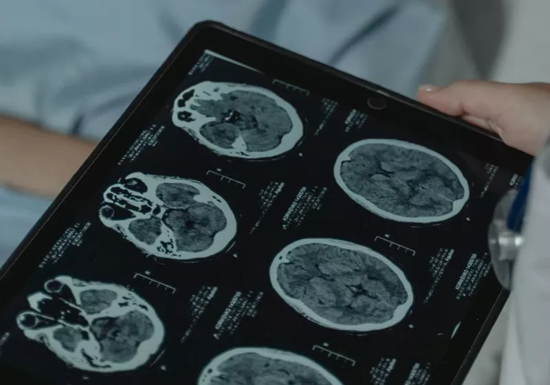 Bilim insanları, genetik düzenleme yoluyla kanser hücrelerinin kendi kendini yok etmesini sağladı 26 bilim insanlari genetik duzenleme yoluyla kanser hucrelerinin kendi kendini yok etmesini sagladi UWuvgp3J