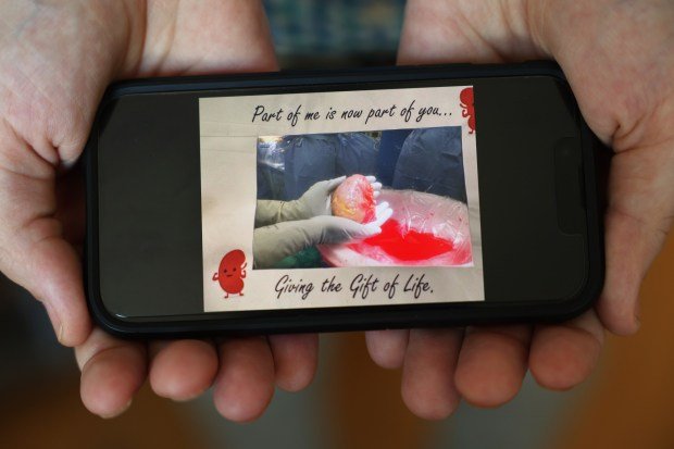 'Güçlü, derin bir deneyim': Hasta, Northwestern Medicine'de ilk uyanık böbrek nakli sırasında rock şarkısını söyledi 1 John Nicholas displays a picture on his phone of the living donor kidney he received from a friend for transplant. (John J. Kim/Chicago Tribune)